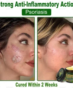 Bellelala® Bee Venom Multi-Care Repair Cream