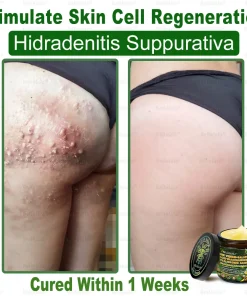 Bellelala® Bee Venom Multi-Care Repair Cream