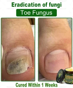 Bellelala® Bee Venom Multi-Care Repair Cream