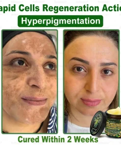 Bellelala® Bee Venom Multi-Care Repair Cream