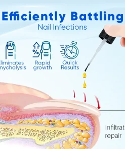 Biancat® OnyxoGuard Nail Growth and Repair Serum