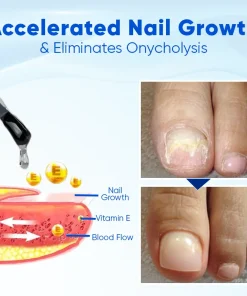 Biancat® OnyxoGuard Nail Growth and Repair Serum