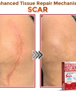 BotaniClear™ USA-Made MicroNeedle Patch for Skin Tags