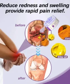 Nexisify™ 𝐓𝐮𝐫𝐦𝐞𝐫𝐢𝐜 & 𝐄𝐦𝐮 𝐎𝐢𝐥 𝐀𝐫𝐭𝐡𝐫𝐢𝐭𝐢𝐬 𝐒𝐨𝐨𝐭𝐡𝐢𝐧𝐠 𝐏𝐚𝐢𝐧 𝐑𝐞𝐥𝐢𝐞𝐟 𝐌𝐚𝐬𝐬𝐚𝐠𝐞 𝐆𝐞𝐥