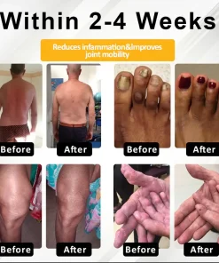 NovaRX® Motion+ Herbal Joint Comfort Balm