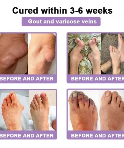 POLARFRESH® Bee Venom & Botulinum Toxin Joint Pain Relief & Repair Cream