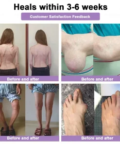 POLARFRESH® Bee Venom & Botulinum Toxin Joint Pain Relief & Repair Cream