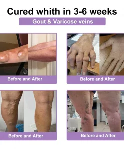 POLARFRESH® Bee Venom & Botulinum Toxin Joint Pain Relief & Repair Cream