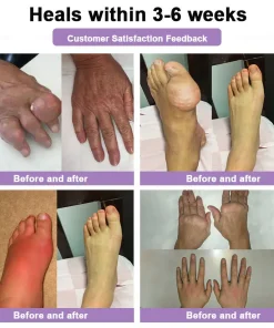 POLARFRESH® Bee Venom & Botulinum Toxin Joint Pain Relief & Repair Cream