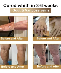 PolarFresh® Bee Venom & Botulinum Toxin Joint Pain Relief & Repair Cream