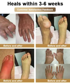 PolarFresh® Bee Venom & Botulinum Toxin Joint Pain Relief & Repair Cream