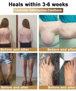 PolarFresh® Bee Venom & Botulinum Toxin Joint Pain Relief & Repair Cream