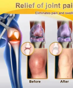 PolarFresh® Bee Venom & Botulinum Toxin Joint Pain Relief & Repair Cream