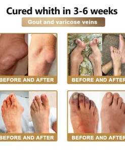 PolarFresh® Bee Venom & Botulinum Toxin Joint Pain Relief & Repair Cream