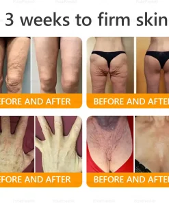 PolarFresh® Bee Venom Wrinkle-Firming Multi-purpose Cream