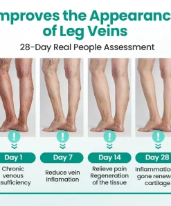 TMRelieve® Legrenew Varicose Veins Patch