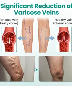 TMRelieve® Legrenew Varicose Veins Patch