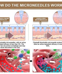 𝐏𝐢𝐠𝐮𝐢𝐚𝐲® 𝐍𝐈𝐃𝐃𝐊-𝐓𝐢𝐫𝐳𝐞𝐩𝐚𝐭𝐢𝐝𝐞 𝐒𝐥𝐢𝐦𝐦𝐢𝐧𝐠 & 𝐡𝐞𝐚𝐥𝐭𝐡 𝐍𝐀𝐍𝐎 𝐌𝐈𝐂𝐑𝐎𝐍𝐄𝐄𝐃𝐋𝐄 𝐏𝐀𝐓𝐂𝐇