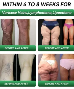 𝐊𝐞𝐲𝐞𝐬𝐬® 𝐆𝐋𝐏-𝟏 & 𝐌𝐚𝐭𝐫𝐢𝐱𝐲𝐥 𝟑𝟎𝟎𝟎 𝐒𝐥𝐢𝐦𝐦𝐢𝐧𝐠 & 𝐇𝐞𝐚𝐥𝐭𝐡 𝐃𝐫𝐨𝐩𝐬