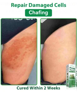 𝐹𝑎𝑡𝑜𝑛𝑔® 𝐹𝑟𝑜𝑔 𝑀𝑢𝑐𝑢𝑠 𝑆𝑘𝑖𝑛 𝑅𝑒𝑝𝑎𝑖𝑟 𝑆𝑝𝑟𝑎𝑦