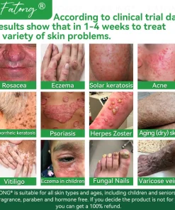 𝐹𝑎𝑡𝑜𝑛𝑔® 𝐹𝑟𝑜𝑔 𝑀𝑢𝑐𝑢𝑠 𝑆𝑘𝑖𝑛 𝑅𝑒𝑝𝑎𝑖𝑟 𝑆𝑝𝑟𝑎𝑦