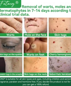 𝐹𝑎𝑡𝑜𝑛𝑔® 𝐹𝑟𝑜𝑔 𝑀𝑢𝑐𝑢𝑠 𝑆𝑘𝑖𝑛 𝑅𝑒𝑝𝑎𝑖𝑟 𝑆𝑝𝑟𝑎𝑦