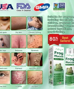 𝐹𝑎𝑡𝑜𝑛𝑔® 𝐹𝑟𝑜𝑔 𝑀𝑢𝑐𝑢𝑠 𝑆𝑘𝑖𝑛 𝑅𝑒𝑝𝑎𝑖𝑟 𝑆𝑝𝑟𝑎𝑦