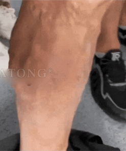 𝐹𝑎𝑡𝑜𝑛𝑔® 𝐹𝑟𝑜𝑔 𝑀𝑢𝑐𝑢𝑠 𝑆𝑘𝑖𝑛 𝑅𝑒𝑝𝑎𝑖𝑟 𝑆𝑝𝑟𝑎𝑦