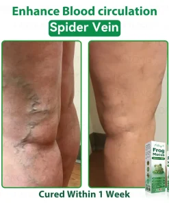 𝐹𝑎𝑡𝑜𝑛𝑔® 𝐹𝑟𝑜𝑔 𝑀𝑢𝑐𝑢𝑠 𝑆𝑘𝑖𝑛 𝑅𝑒𝑝𝑎𝑖𝑟 𝑆𝑝𝑟𝑎𝑦