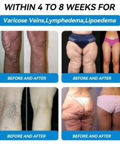 𝐃𝐢𝐚𝐩𝐚𝐬𝐨𝐧® 𝐺𝐿𝑃-1 & 𝑁𝑀𝑁+ 𝑊𝑒𝑖𝑔ℎ𝑡 𝐿𝑜𝑠𝑠 & 𝐵𝑙𝑜𝑜𝑑 𝑆𝑢𝑔𝑎𝑟 𝐶𝑜𝑛𝑡𝑟𝑜𝑙 𝐻𝑖𝑔ℎ𝑙𝑦 𝐸𝑓𝑓𝑒𝑐𝑡𝑖𝑣𝑒 𝑂𝑟𝑎𝑙 𝐿𝑖𝑞𝑢𝑖𝑑