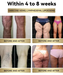 𝑪𝒓𝒂𝒛𝒚𝑳𝒆𝒂𝒇® Tirzepatide 𝗚𝗜𝗣/𝗚𝗟𝗣-𝟭 𝗗𝘂𝗮𝗹-𝗔𝗰𝘁𝗶𝗼𝗻 𝑺𝒍𝒊𝒎𝒎𝒊𝒏𝒈 & 𝑯𝒆𝒂𝒍𝒕𝒉 𝑩𝒐𝒐𝒔𝒕 𝑫𝒓𝒐𝒑𝒔