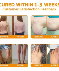 AQA™ Botulinum and Bee Toxin Pain Relief Bone Healing Cream