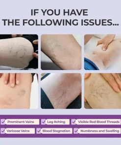 AQA™ Leg Relief Varicose Veins Cream