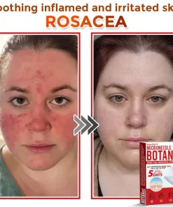 BotaniDot™ MicroNeedle Botanic Skin Tag Removal Patch