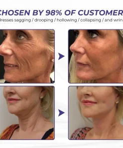 Brightmarsh® ElastaPro Emu Oil Skin Firming Cream