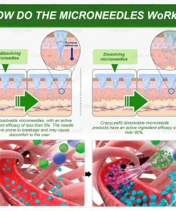 CrazyLeaf® SMGT-GLP-1 Nano Microneedle Patch