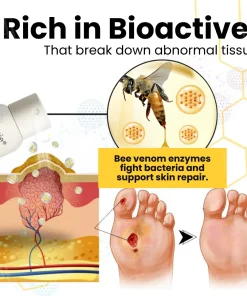Croaie® Bee Venom Diabetic Foot Ulcer Spray