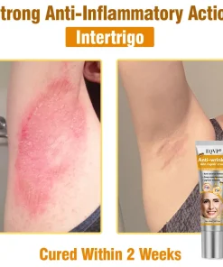 EQVP® Anti-wrinkle skin repair cream