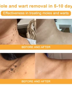 EQVP® Anti-wrinkle skin repair cream