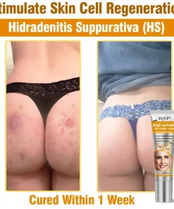 EQVP® Anti-wrinkle skin repair cream