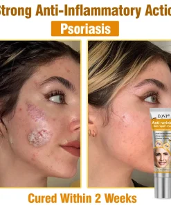 EQVP® Anti-wrinkle skin repair cream