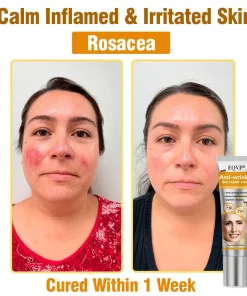 EQVP® Anti-wrinkle skin repair cream