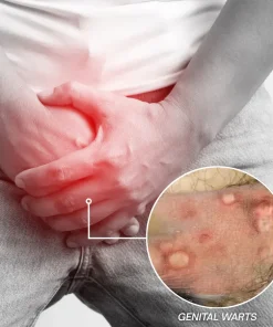 Femica® GentX WartRelief Cream