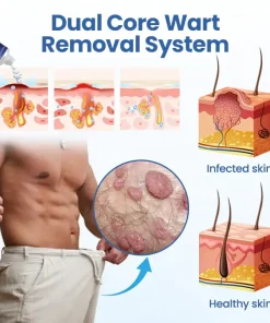 Femica® GentX WartRelief Cream