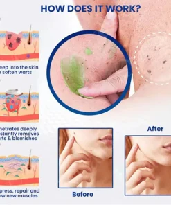 Femica™ NatureErase Instant Mole & Spot Cream