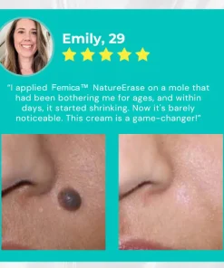 Femica™ NatureErase Instant Mole & Spot Cream