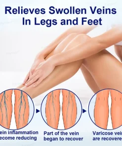 Furzero® VeinFreedom Herbal Spray