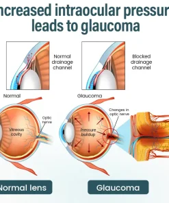 HZA® OptiFusion Nano Eye Drops Serum