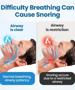 Juxek® SnoreLess Nasal Breather
