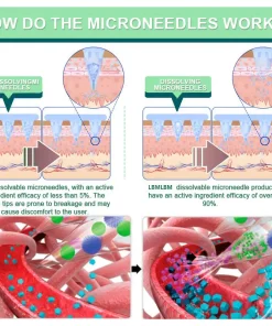 LBMLBM™ NIDDK-Tirzepatide Slimming & health NANO MICRONEEDLE PATCH
